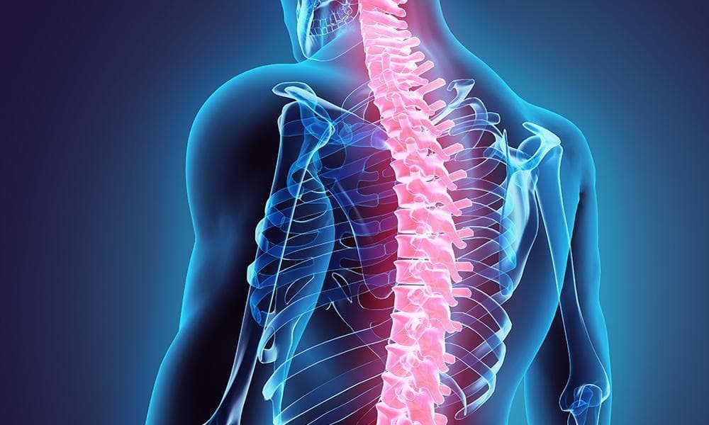 Kyphoplasty Offers Permanent Fix for Vertebrae Fractures